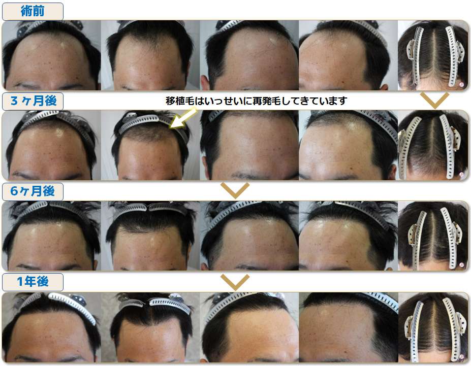 術前写真