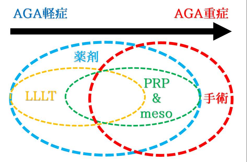AGA治療法の関連