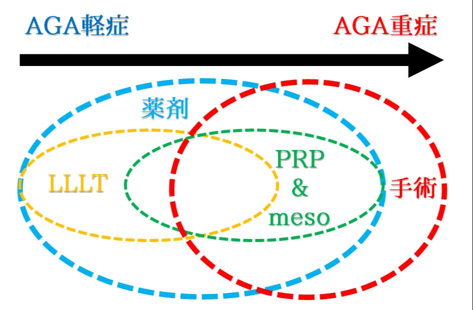 AGA治療法の関連