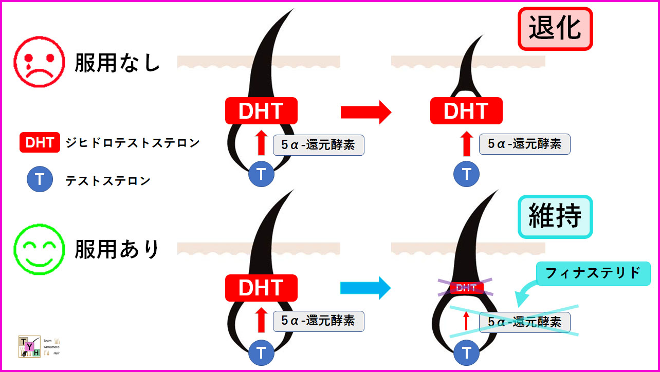 プロペシアの作用