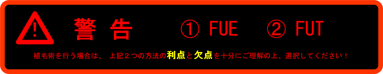 植毛術の術式選択の注意点