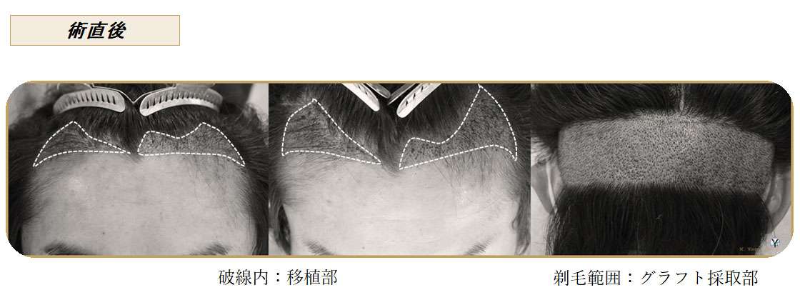 術後写真