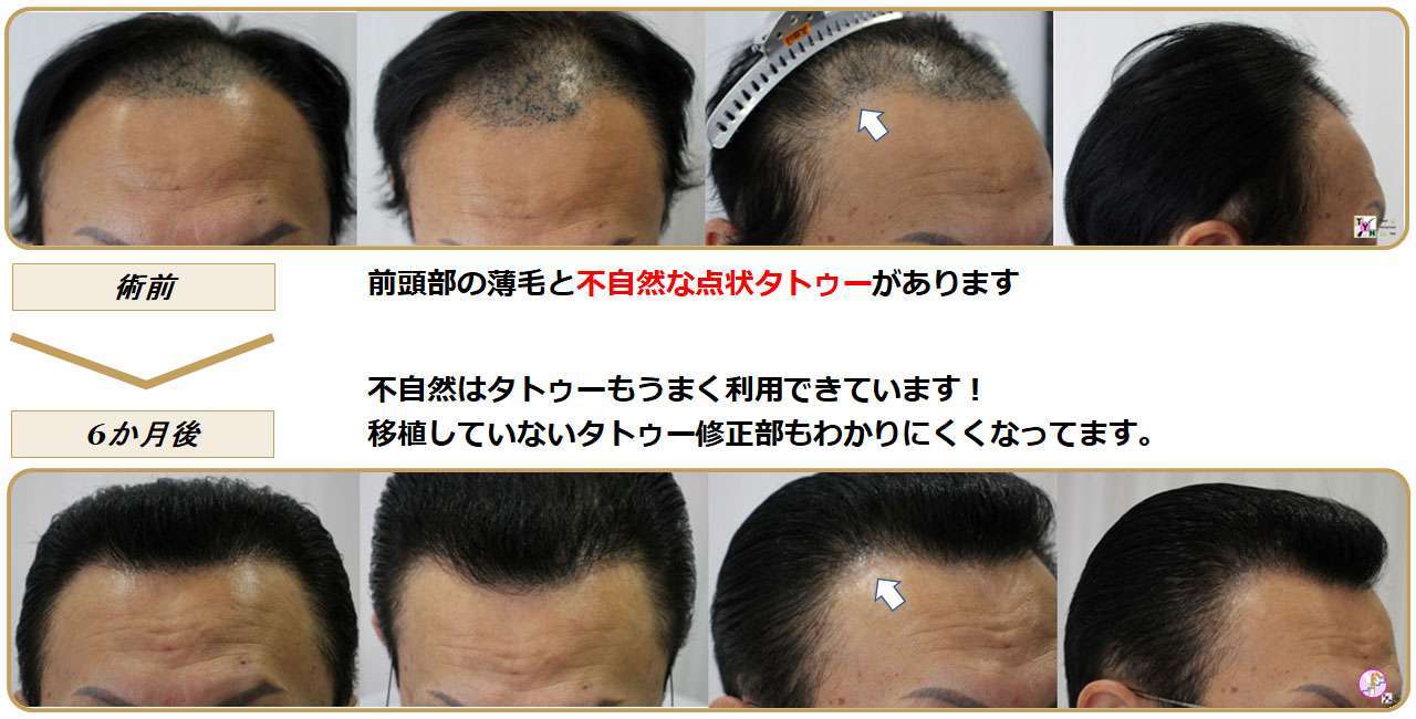 術前・術後写真