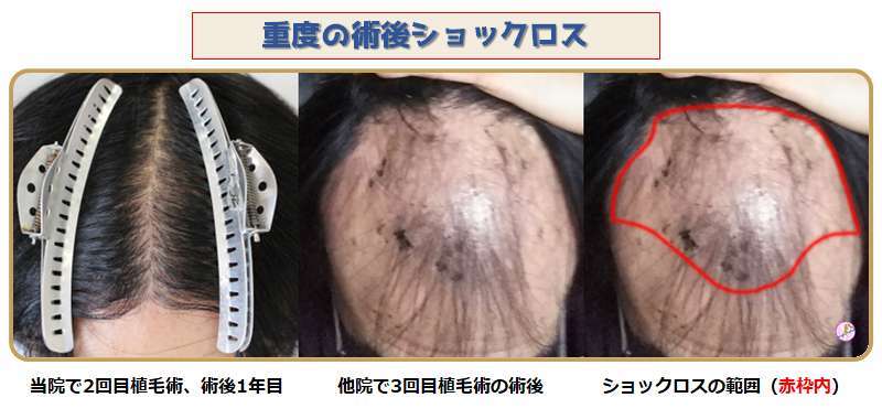 術前・術後写真