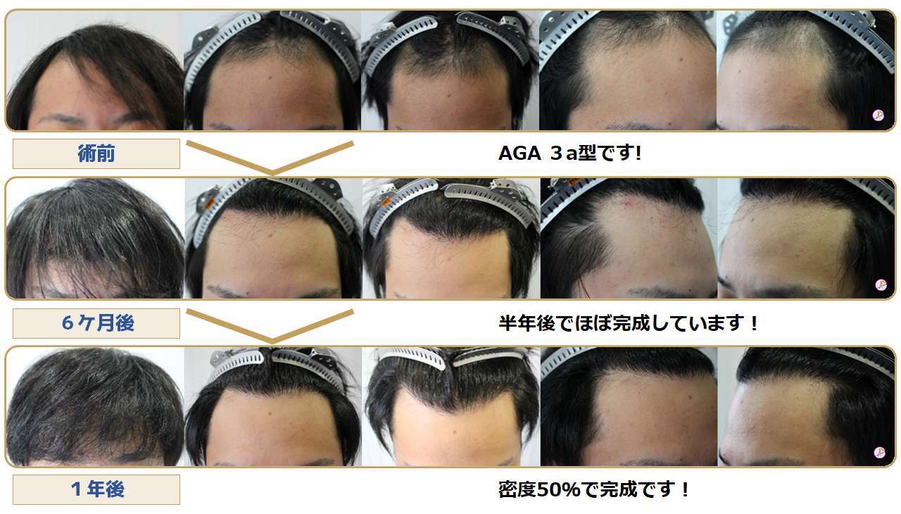 術前・術後写真