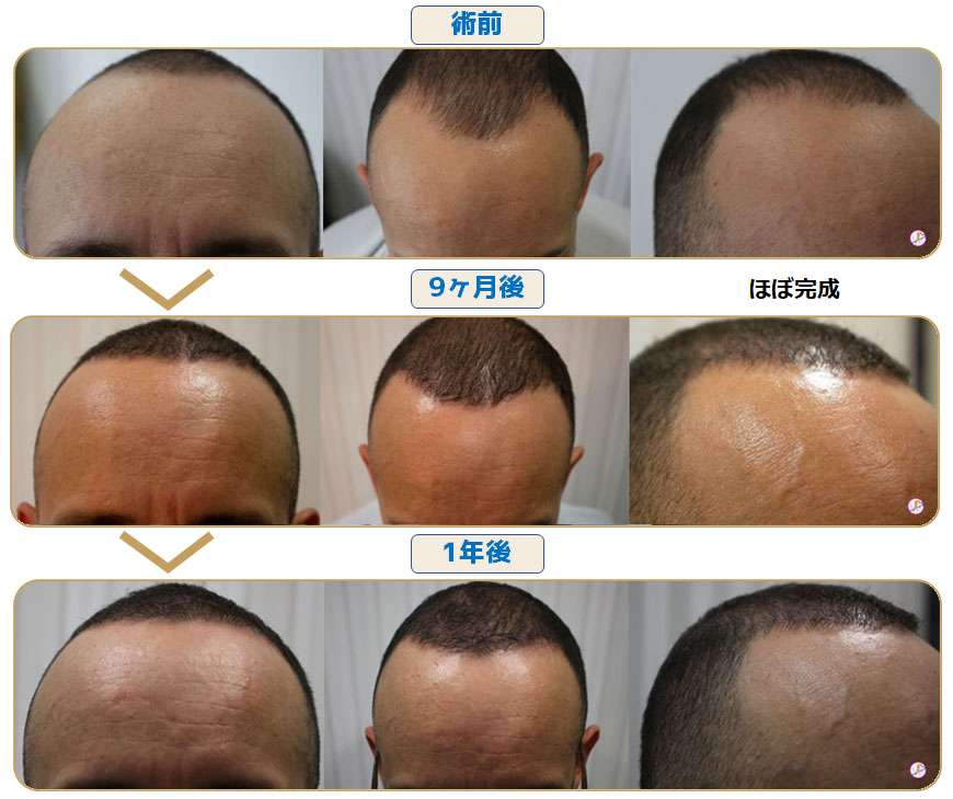 術前術後写真