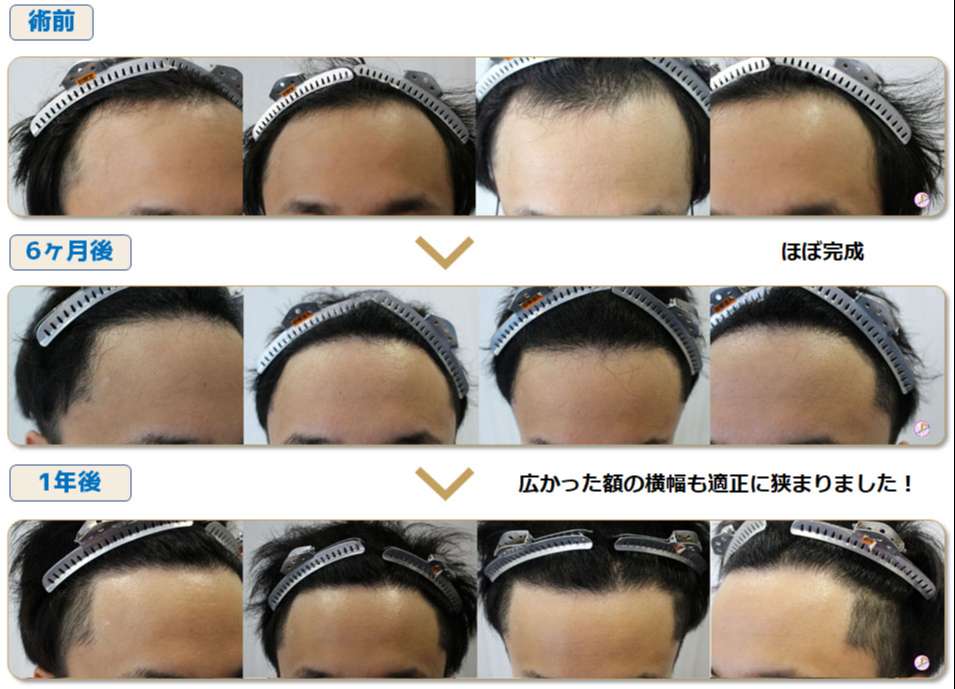 術前術後写真