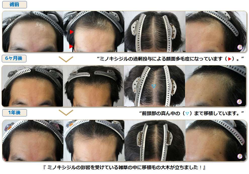 術前術後写真