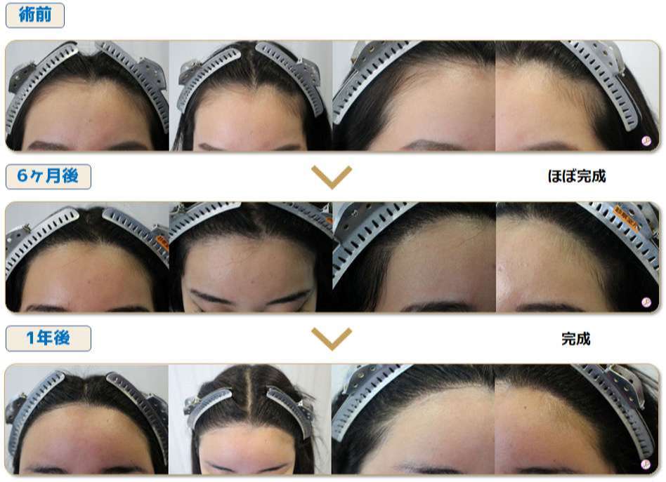 術前術後写真