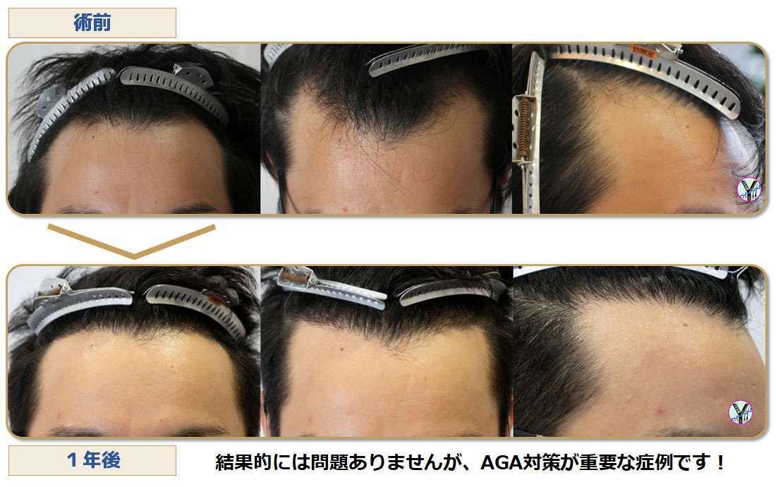 術前術後写真