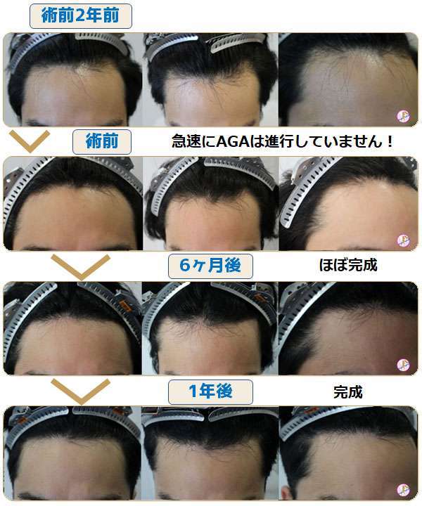 術前術後写真