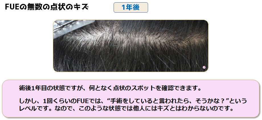 術後ドナー部