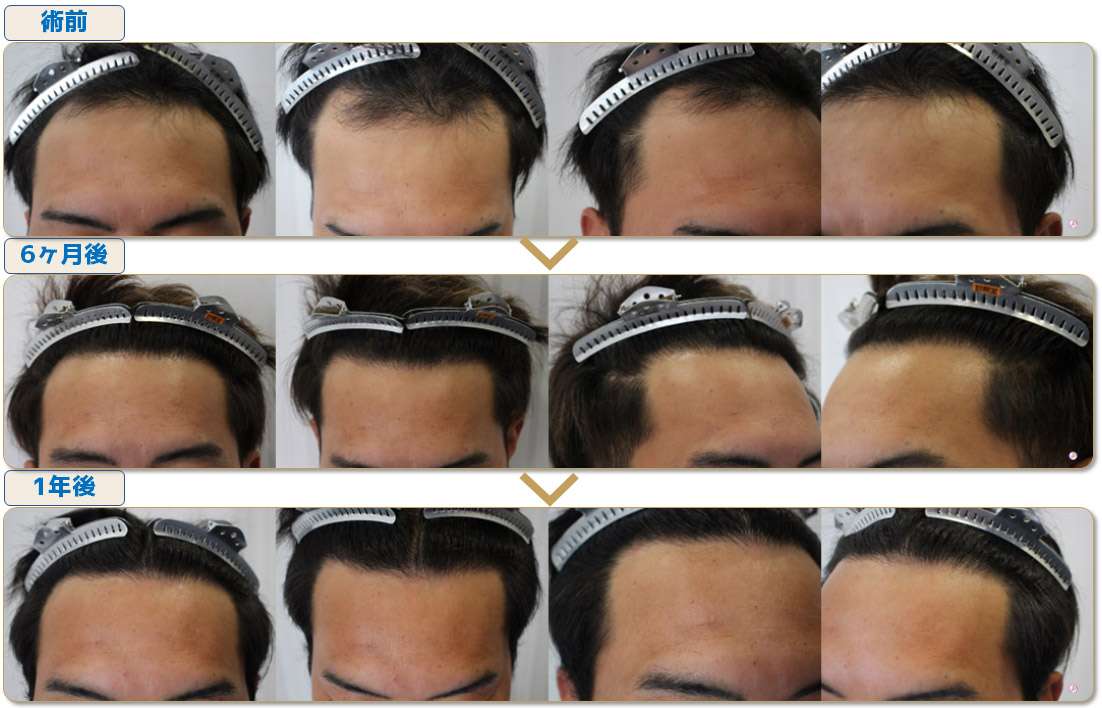 術前・術後写真
