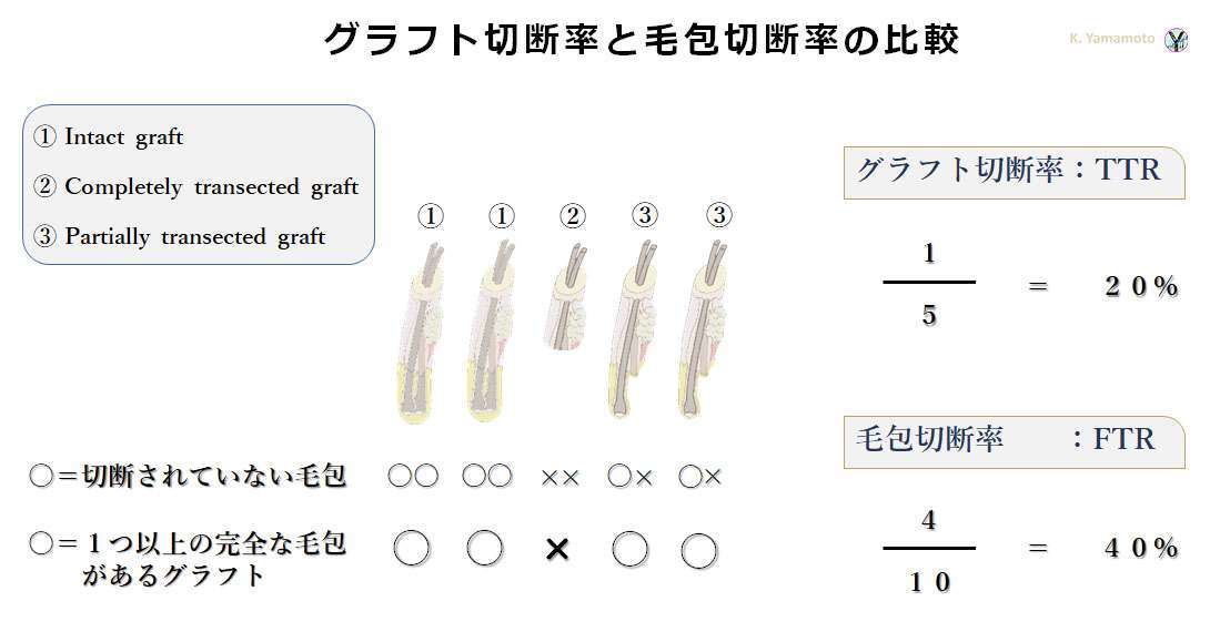グラフト切断率と毛包切断率の比較