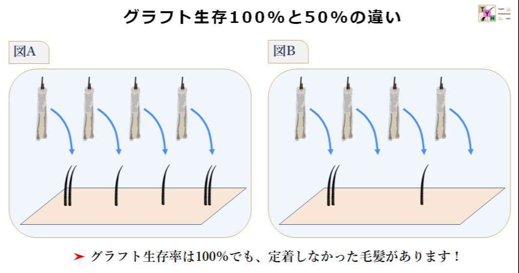 グラフト生存率100%と50%の違い