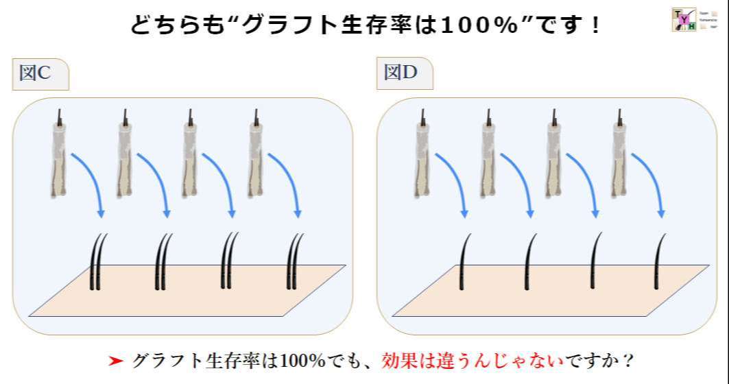 グラフト生存率100%でも結果は違う