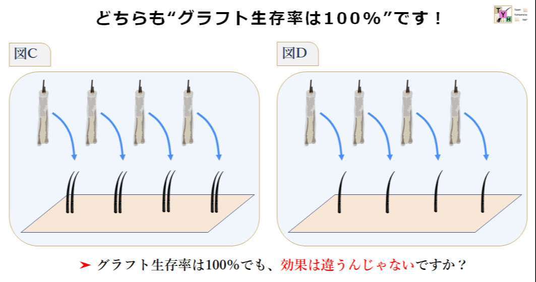 グラフト生存率100％でも結果は違う