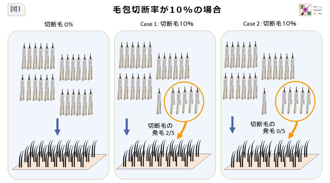 毛包切断率FTRが10%の場合